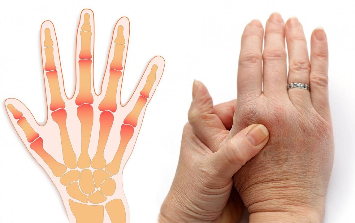 doenças dos dedos