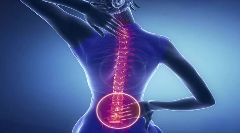 Osteocondrose da coluna