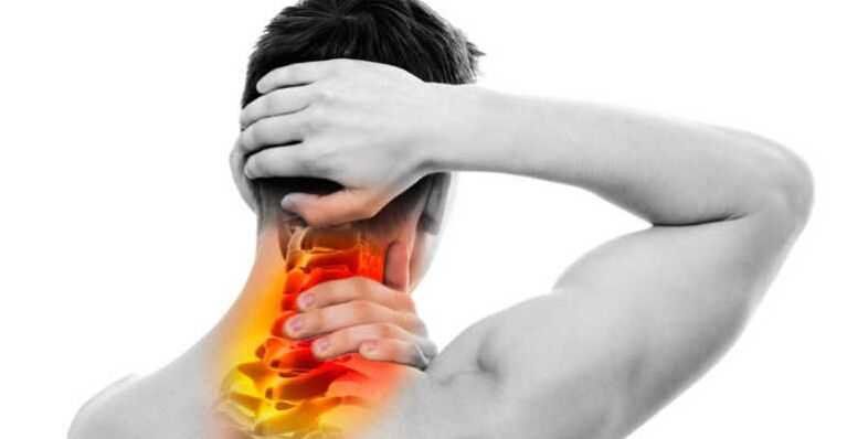 Dor no pescoço e sinais de osteocondrose