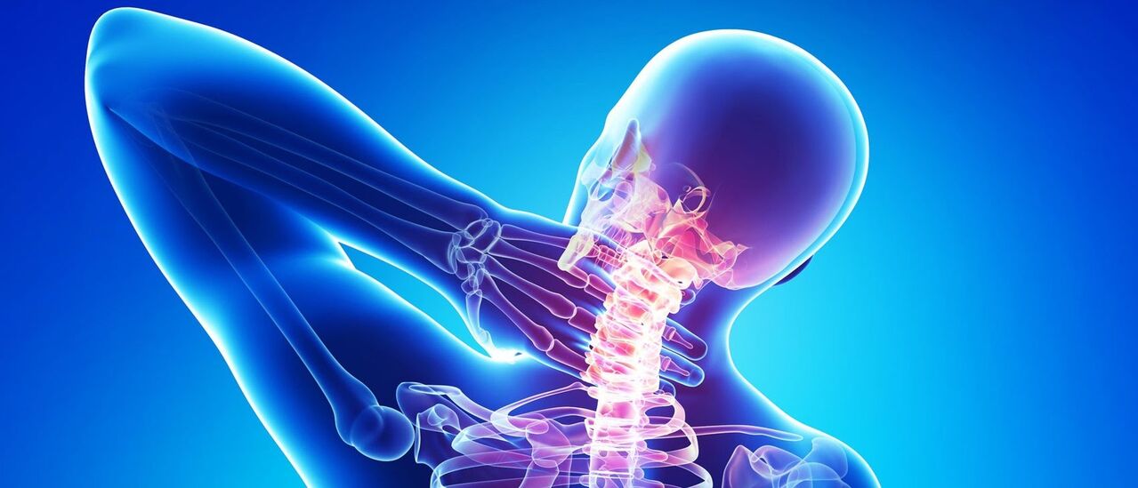 Osteocondrose cervical é um processo patológico na área da coluna
