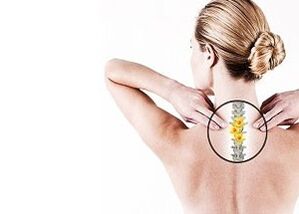 osteocondrose da coluna torácica