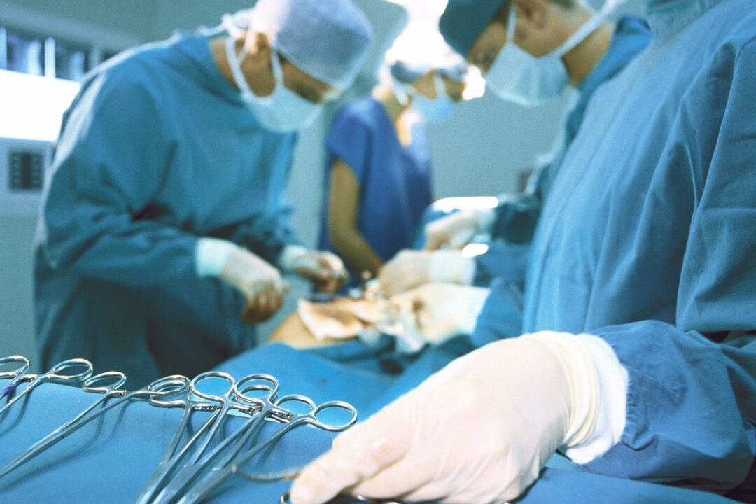 tratamento cirúrgico da osteocondrose